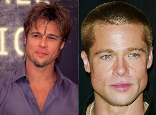 Brad Pitt après musculation du masseter muscles-changer-de-visage-machoire-brad-pitt